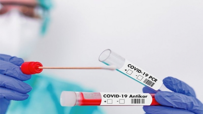 Avusturya’da Aile Doktorları Ön Korona (Antijen) Testi Yapabilecek
