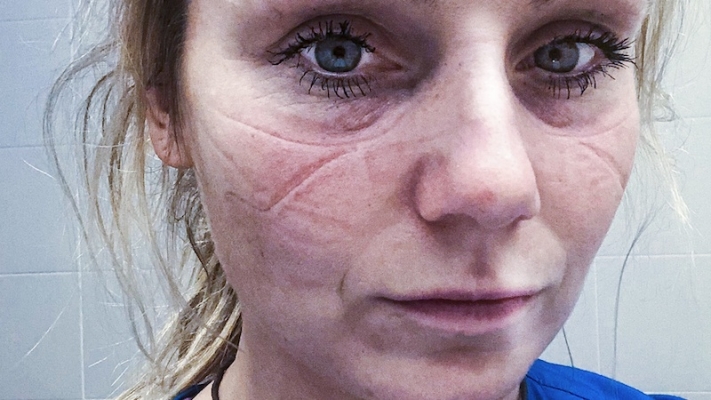 Maske İzi Onların Yüzlerine, Bizim İse Yüreklerimize Kazındı