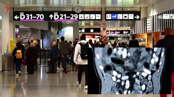 Viyana | Midesinde Yarım Milyon Euro Değerinde Uyuşturucuyla Yakalandı