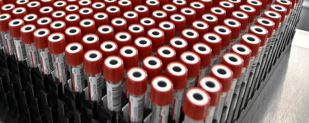Unterschiedliche Kosten für Tests