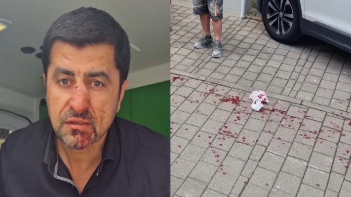 SPD’li Halil Taşdelen ırkçı saldırıya uğradı